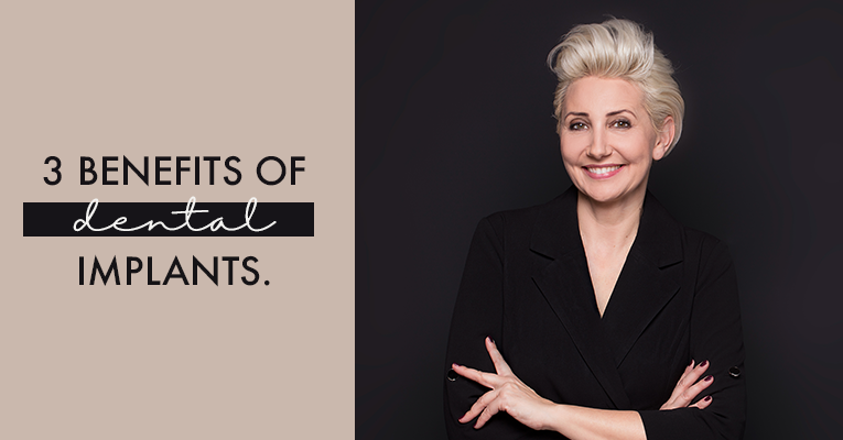 Blog, 3 Benefits of Dental Implants